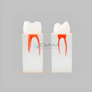 Modelo de diente para tratamiento de endodoncia con pared pulpar y coronas coloreadas