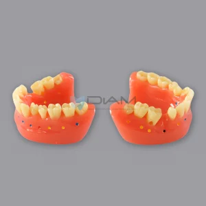 Modelo de estudio de cepillado interdental