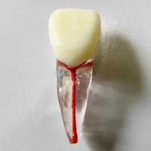 Diente para endodoncia anatómico de cavidad pulpar radicular para práctica de endodoncia