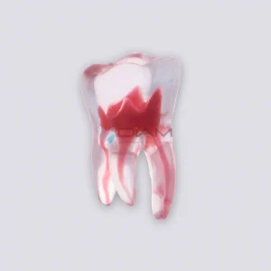 Modelo de diente para tratamiento de endodoncia