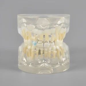 Modelo estándar infantil transparente que representa el crecimiento y la erupción de los dientes de un niño de 3 años