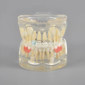 Modelo estándar infantil de dentición mixta