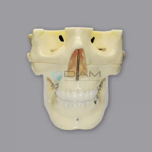 Modelo de implante ortodóntico