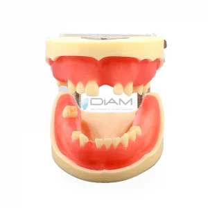 Modelo de implante para la práctica de procedimientos de implantes dentales