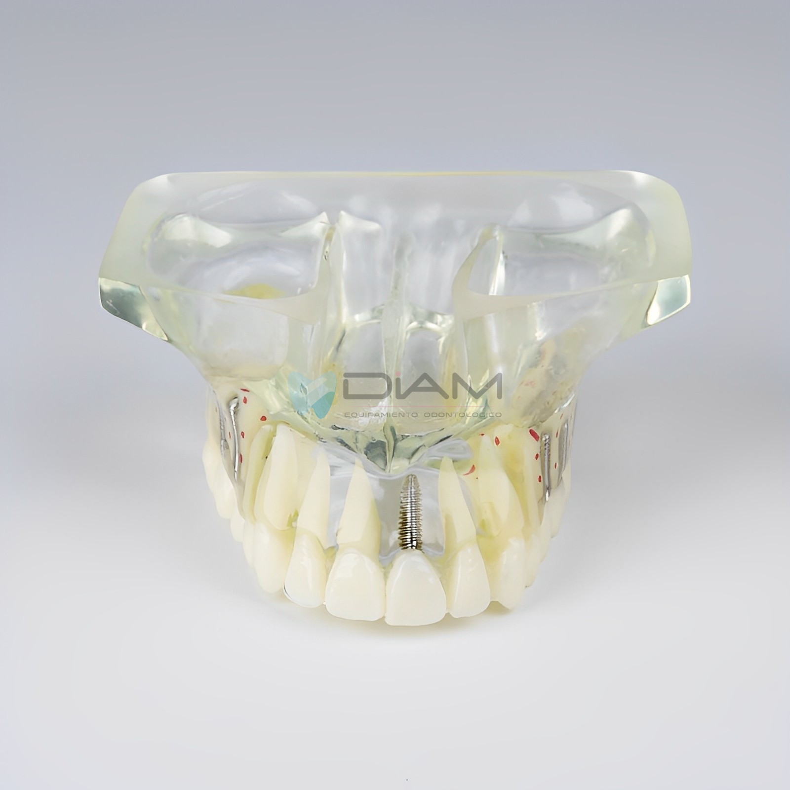 Modelo de implante anatómico transparente