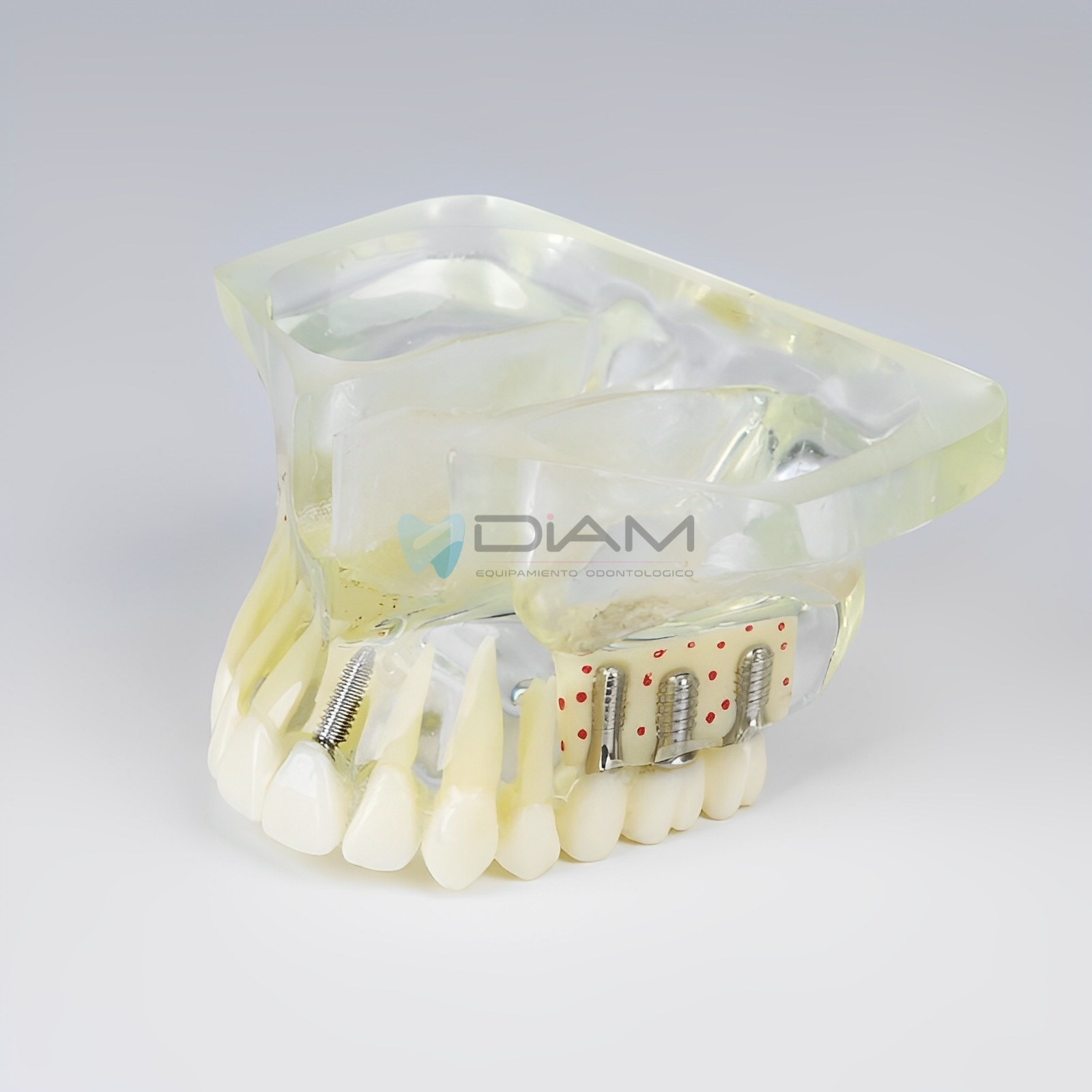 Modelo de implante anatómico transparente - Imagen 2
