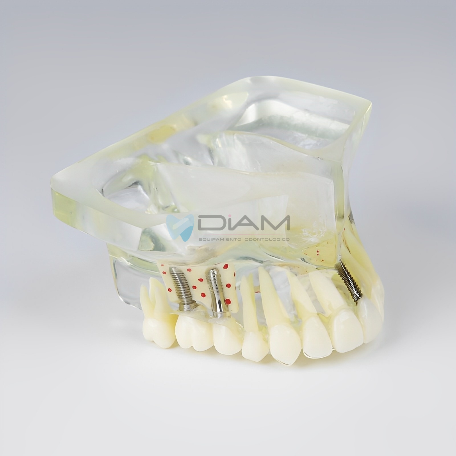 Modelo de implante anatómico transparente - Imagen 3