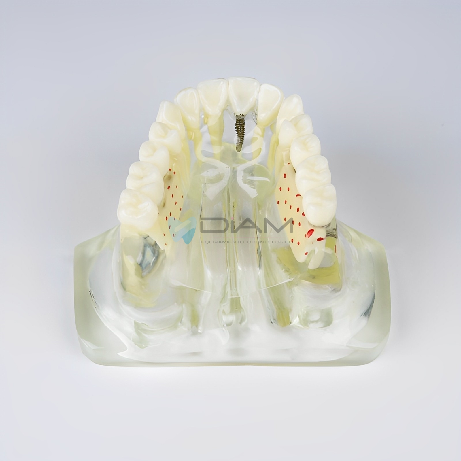 Modelo de implante anatómico transparente - Imagen 4