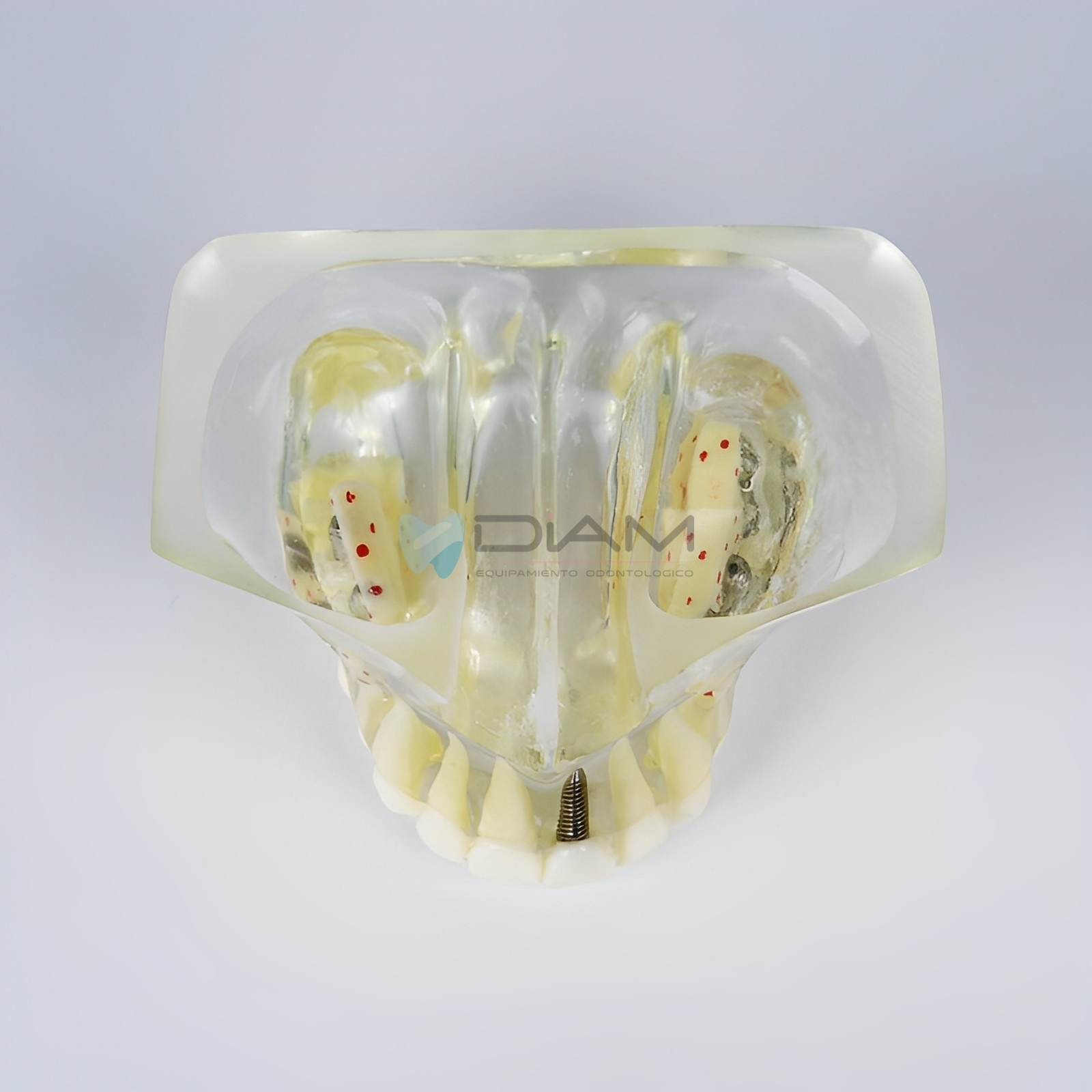 Modelo de implante anatómico transparente - Imagen 5