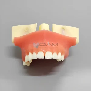 Modelo de elevación de seno maxilar dentado