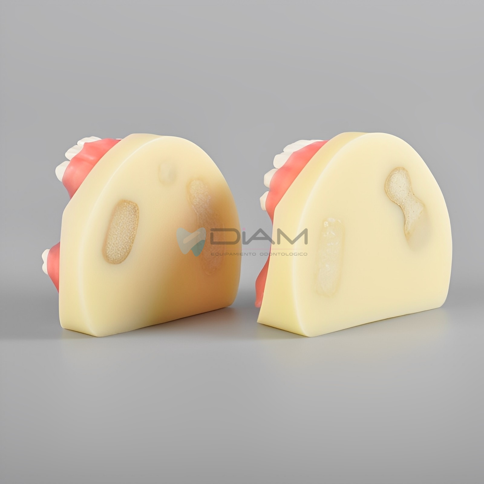 Modelo de práctica anatómico especializado para la práctica de implantes dentales - Imagen 2