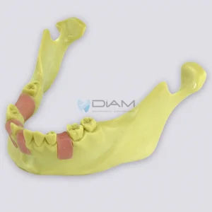 Modelo de práctica de implantes