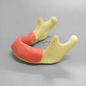 Modelo de práctica de implantes de mandíbula con encía