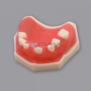 Modelo maxilar superior parcialmente dentado para práctica de implantes y sutura