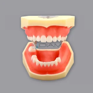 Modelo de implante para la práctica de procedimientos dentales