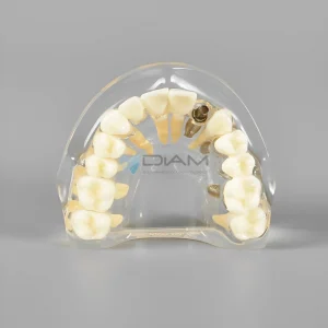 Modelo de implante dental para visualización de implantes, pilares, coronas y puentes.
