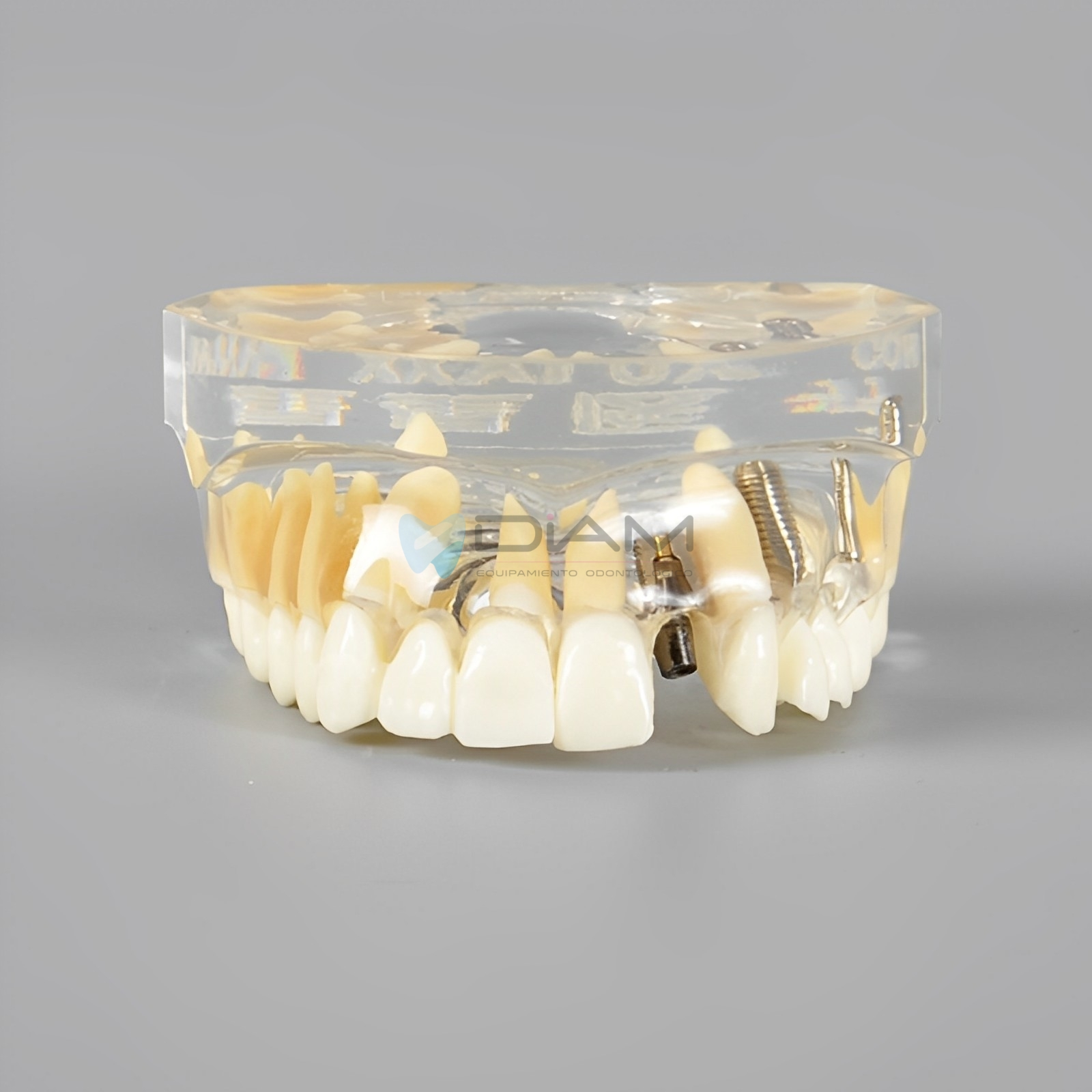 Modelo de implante dental para visualización de implantes, pilares, coronas y puentes. - Imagen 2