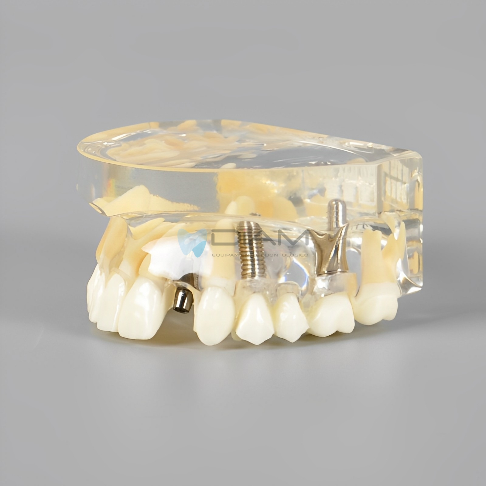 Modelo de implante dental para visualización de implantes, pilares, coronas y puentes. - Imagen 4