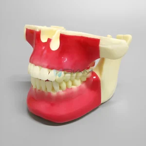 Modelo de mandíbula superior e inferior para práctica de orto implantes.