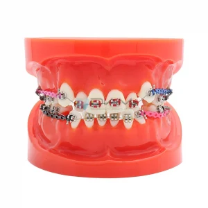 Modelo de Brackets orto metálico (24 piezas)