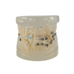 Modelo de Brackets orto metálico (28 piezas) mandíbula transparente