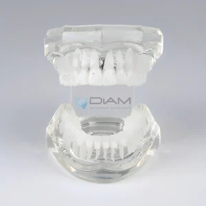 Modelo de Brackets orto cerámico (28 piezas)