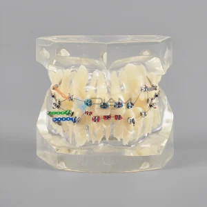 Modelo de Brackets orto metálico (24 piezas)