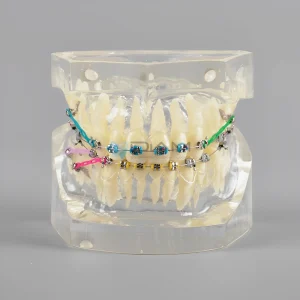 Modelo de Brackets orto metálico