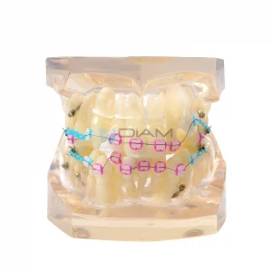 Modelo de Brackets orto cerámico