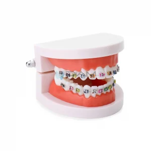 Modelo de Brackets orto metálico