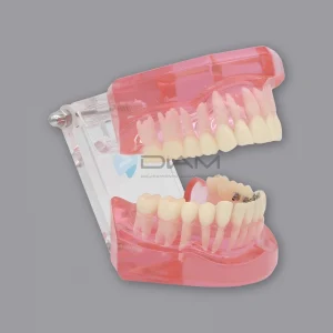 Modelo con Brackets lengua