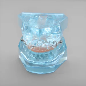 Modelo de ortodoncia transparente