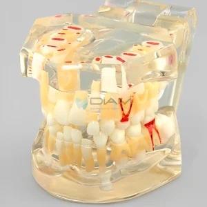 Modelo infantil que muestra la dentición mixta.