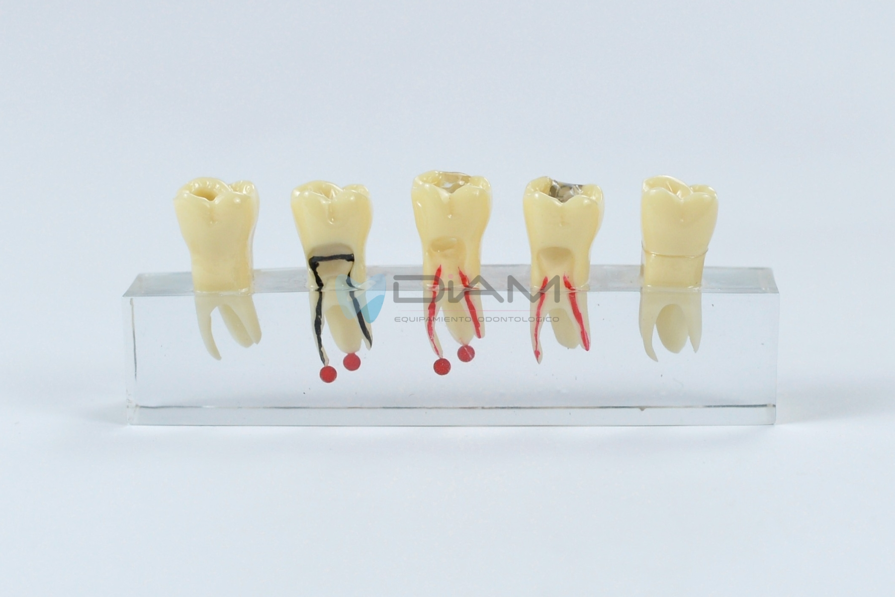 Modelo endodóntico indicando 5 etapas del procedimiento del conducto radicular - Imagen 2