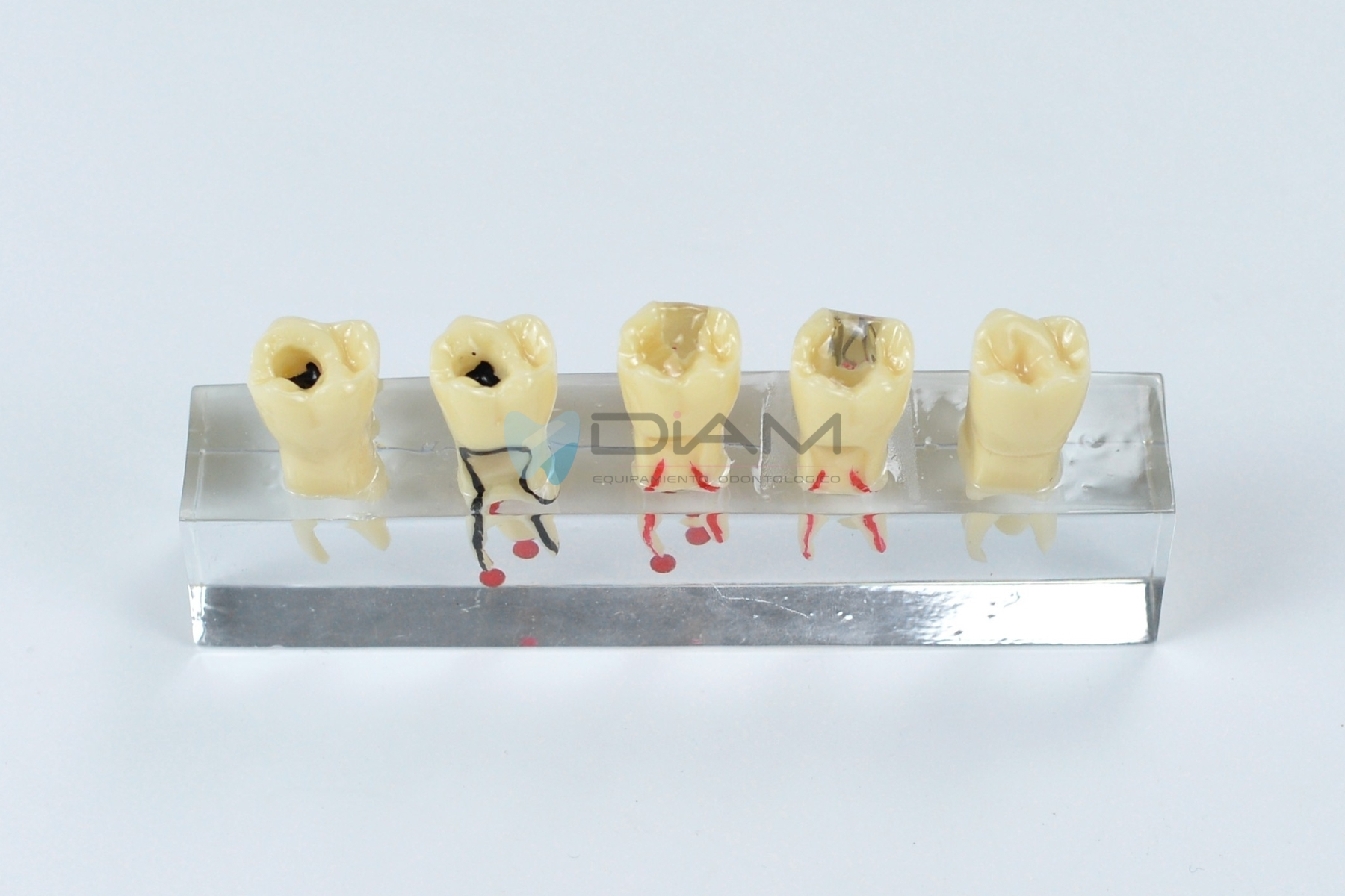 Modelo endodóntico indicando 5 etapas del procedimiento del conducto radicular - Imagen 3