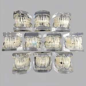 Modelo de maloclusiones transparente orto clasificación (monocromo,10 pcs/set)