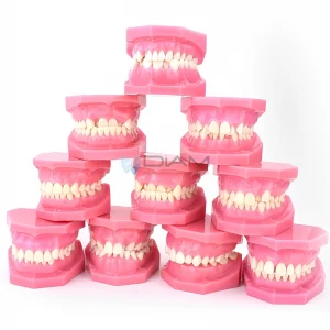 Modelo de maloclusiones orto clasificación (bicolor,10 pcs/set)