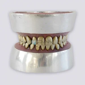 Modelo de extracción de dientes metálicos