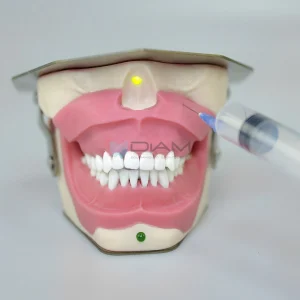 Modelo de extracción y anestesia