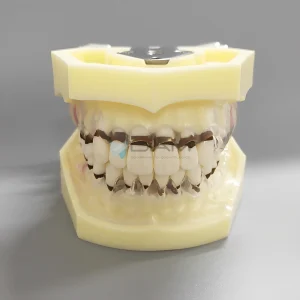 Modelo de enfermedad periodontal con mucosa gingival