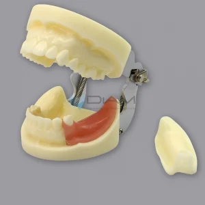 Modelo de mandíbula para diferentes prácticas de implantes.