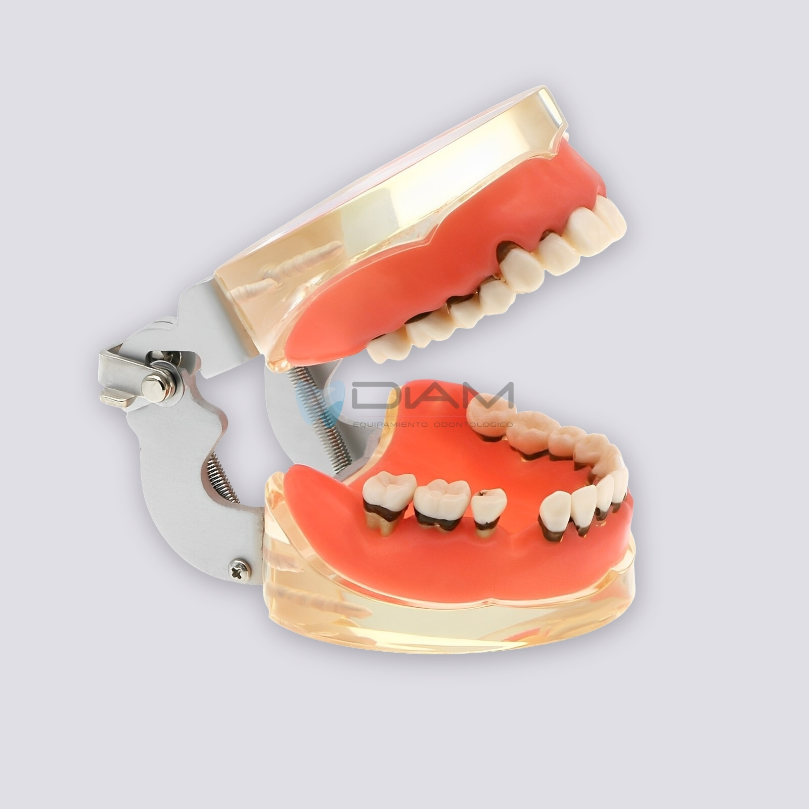 Modelo de enfermedad periodontal con sarro, recesión gingival y encías saludables - Imagen 3