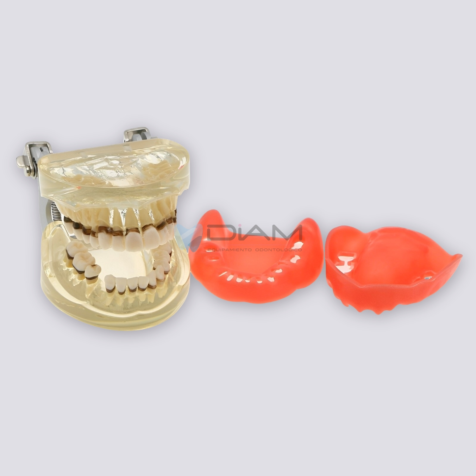 Modelo de enfermedad periodontal con sarro, recesión gingival y encías saludables - Imagen 4