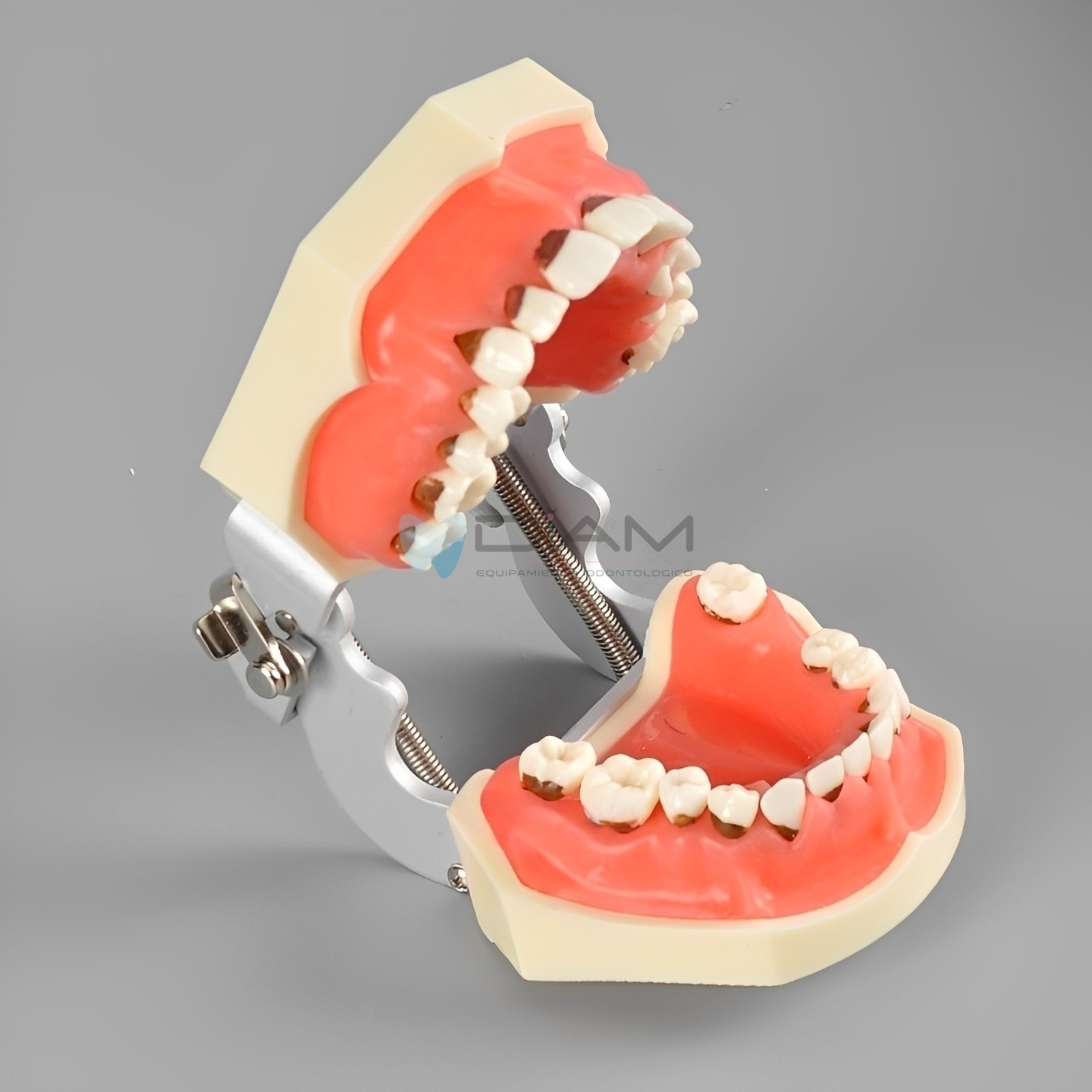 Modelo de enfermedad periodontal. Encías con inflamación severa y cálculo dental - Imagen 4