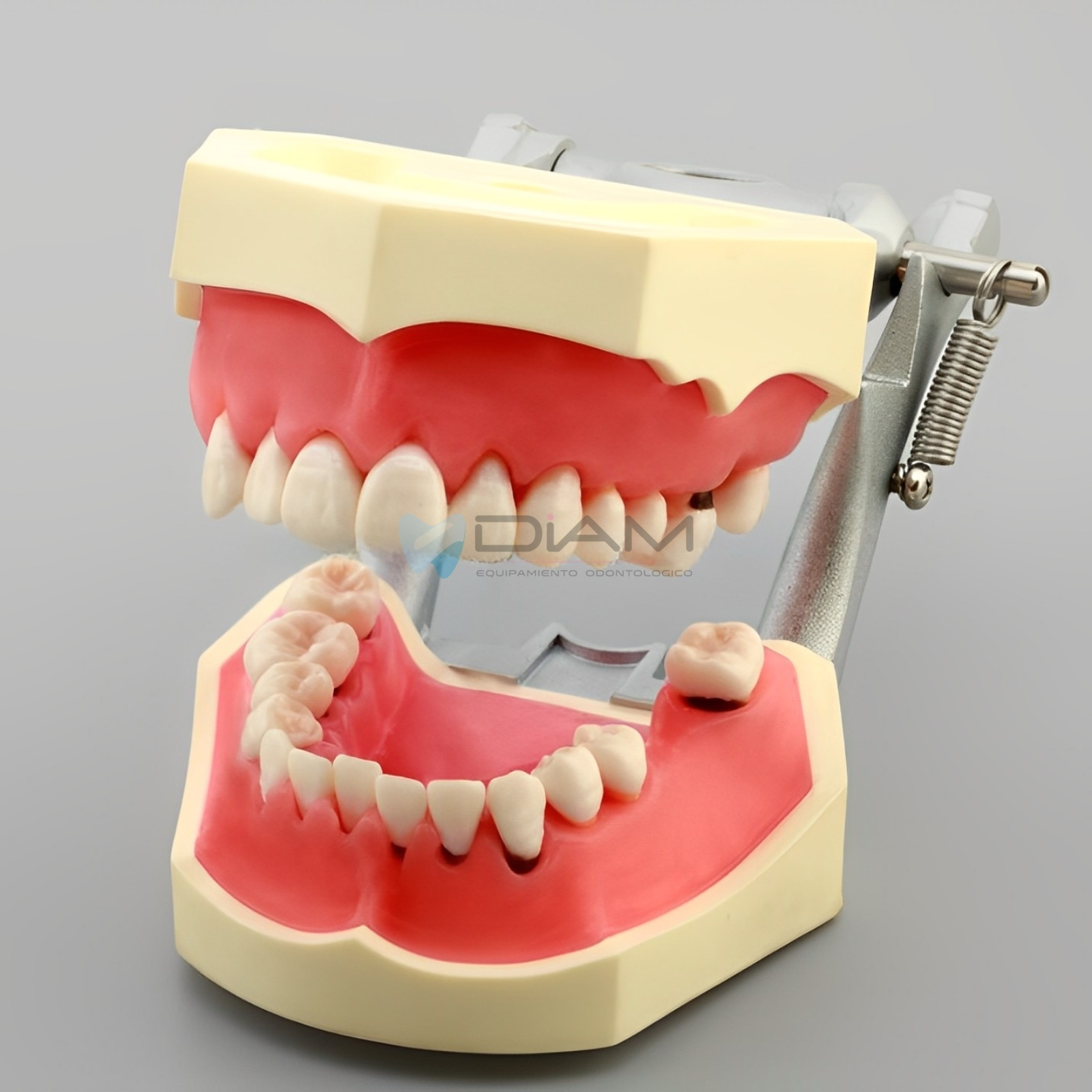 Modelo de enfermedad periodontal con encías severamente inflamadas con cálculo y encías duras - Imagen 2