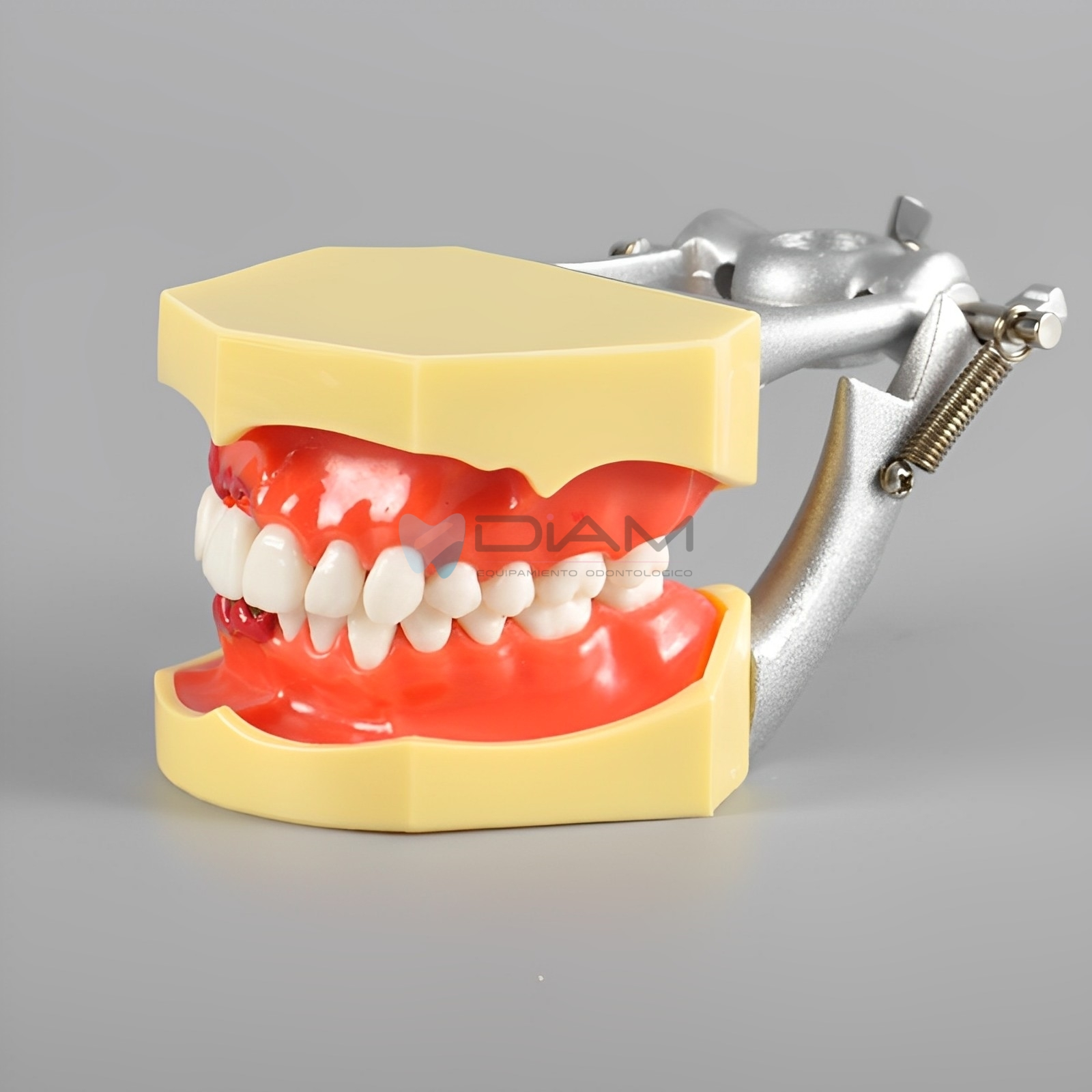 Modelo de enfermedad periodontal con recesión del cálculo gingival y gingivitis. - Imagen 2