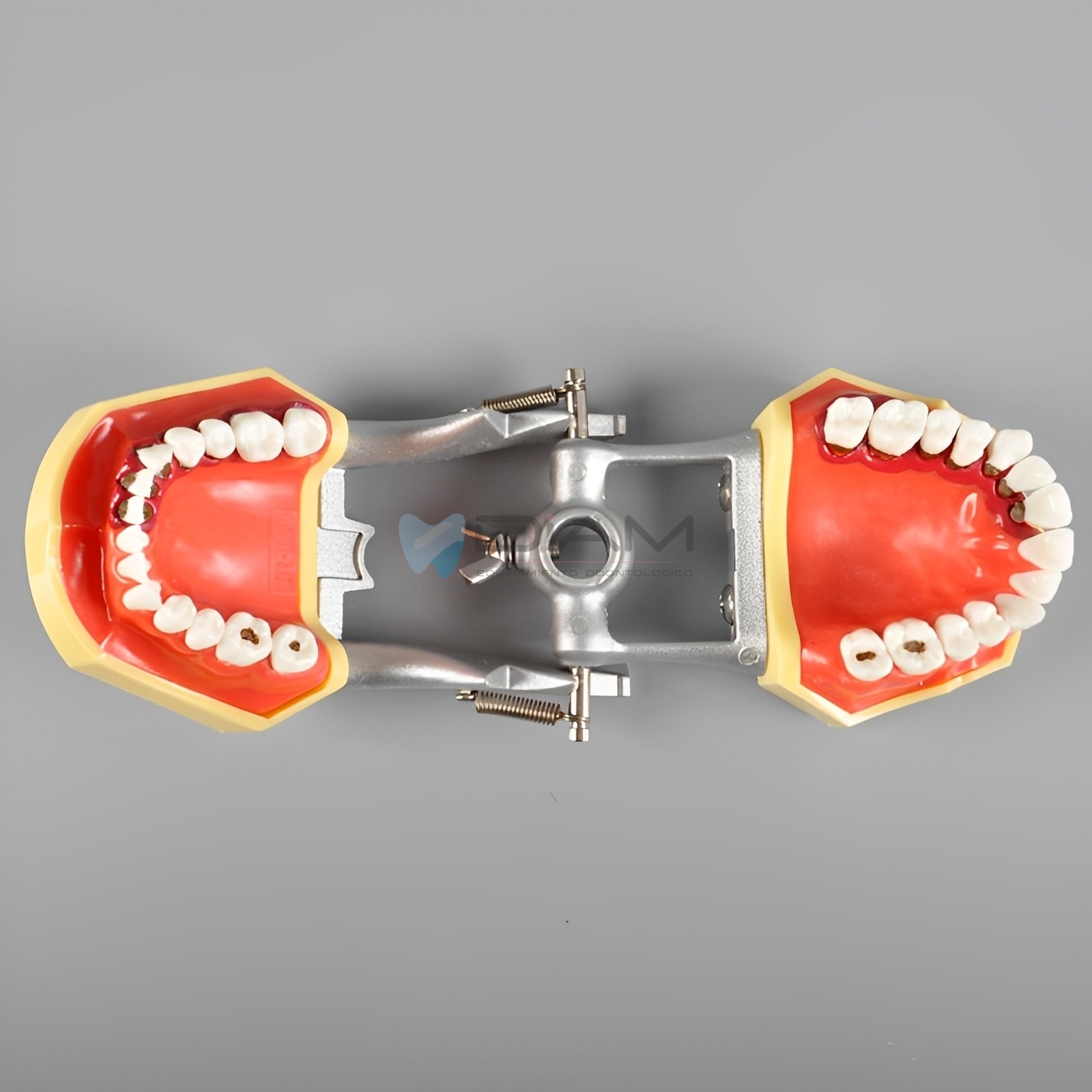 Modelo de enfermedad periodontal con recesión del cálculo gingival y gingivitis. - Imagen 4